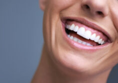 The Role of Oral Health in Hollywood Smile Treatment Why It's More Than Just Looks