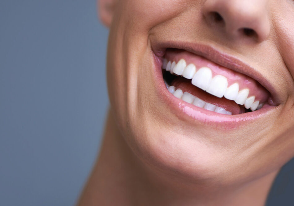 The Role of Oral Health in Hollywood Smile Treatment Why It's More Than Just Looks